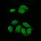 Anti-IKB alpha NFKBIA Rabbit Monoclonal Antibody